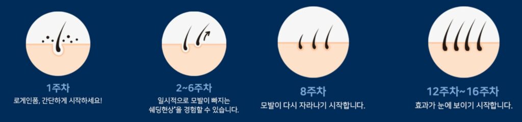 로게인폼 16주차 효과